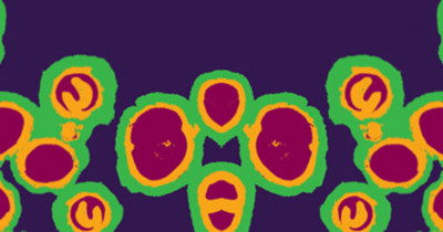 gonorrhoea cells