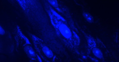 Mycoplasma Mycoplasma
